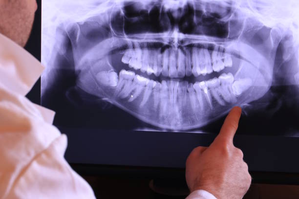Best Teeth Whitening  in Indian River, MI