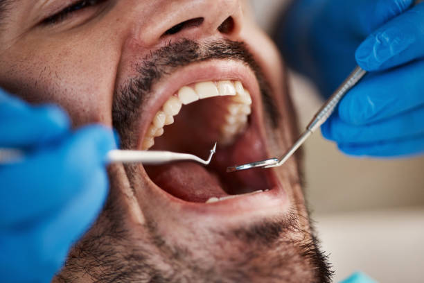 Best Cracked Tooth Emergency Dentist  in Indian River, MI